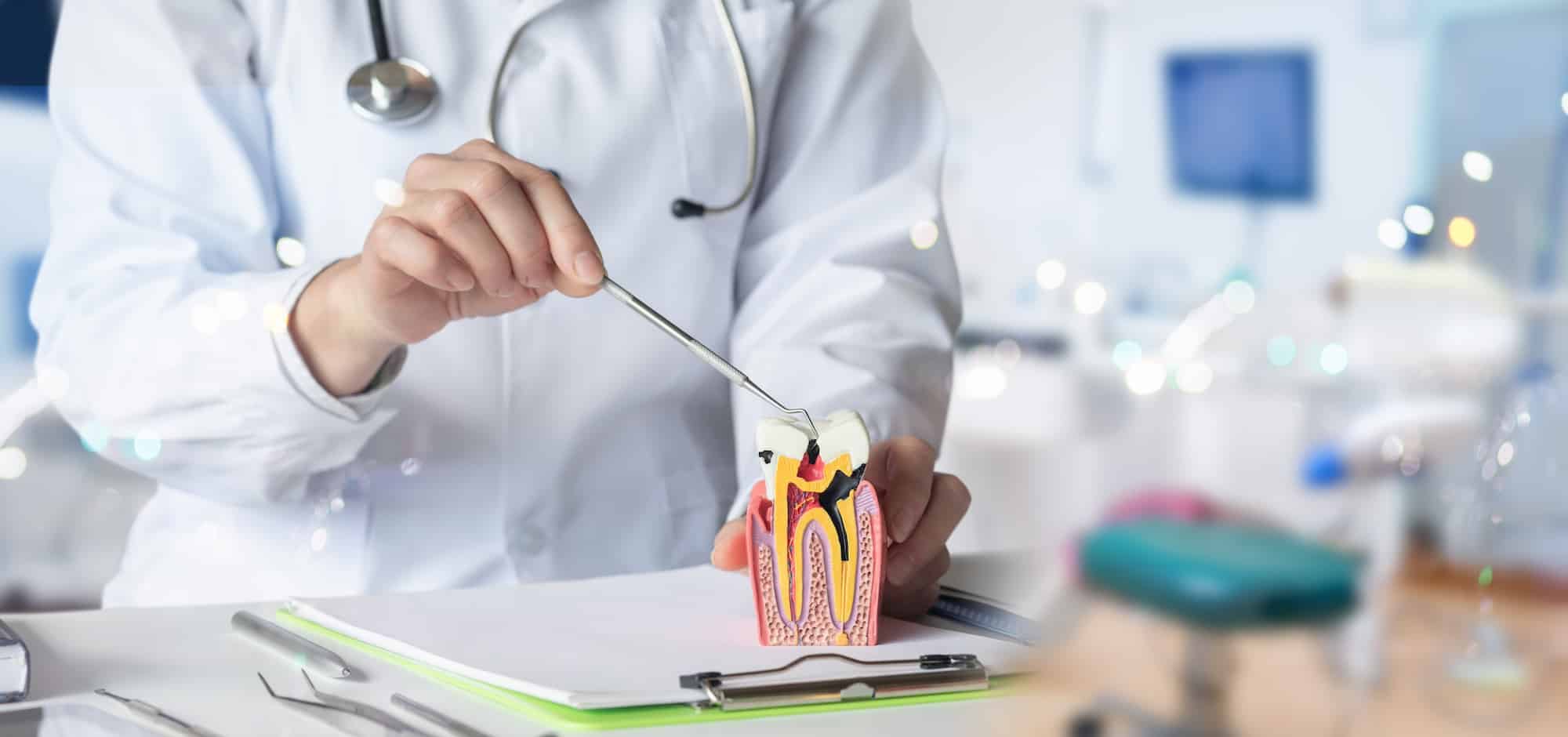 signs you need a root canal