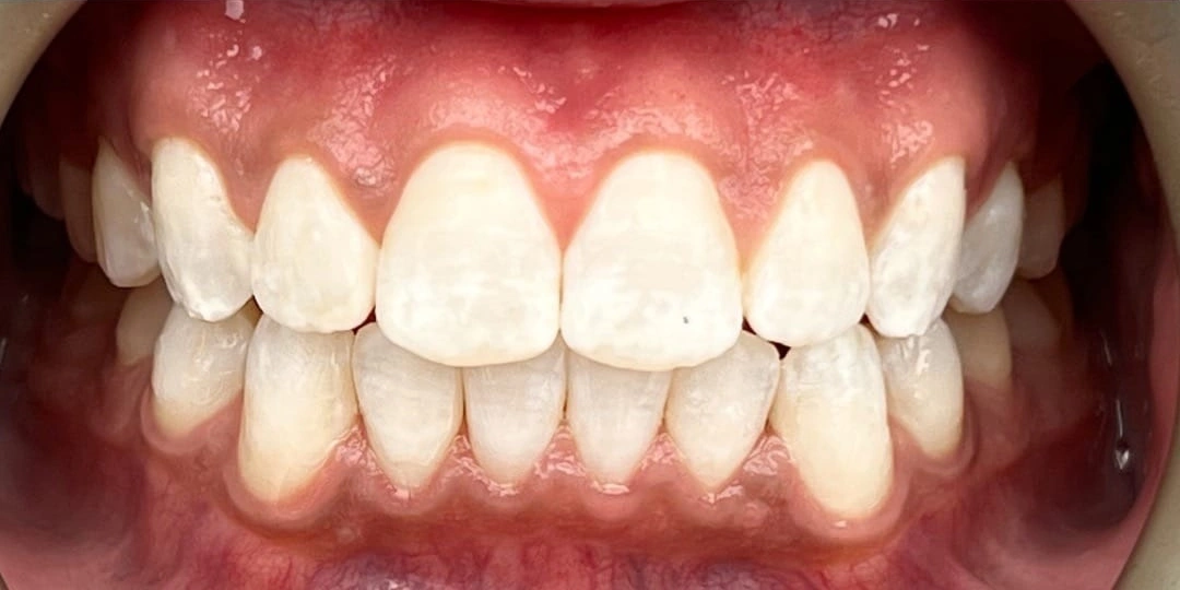 General Dentistry after