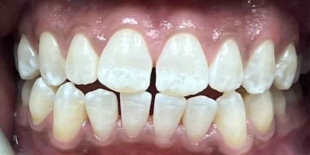 General Dentistry Before