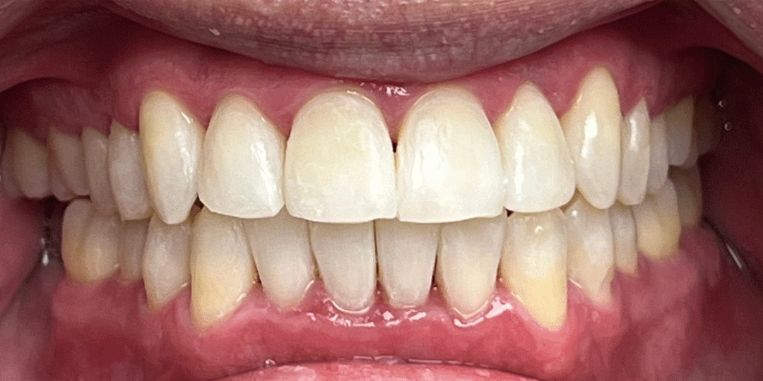 General Dentistry Treatment After