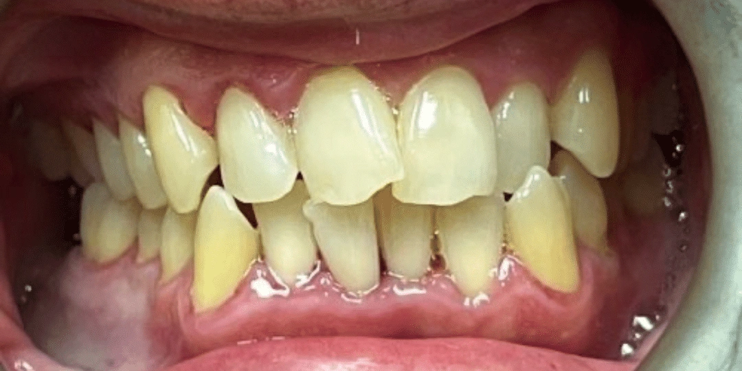 General Dentistry Treatment Before