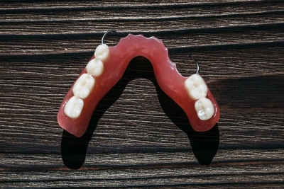 Removable partial dentures used to replace missing teeth